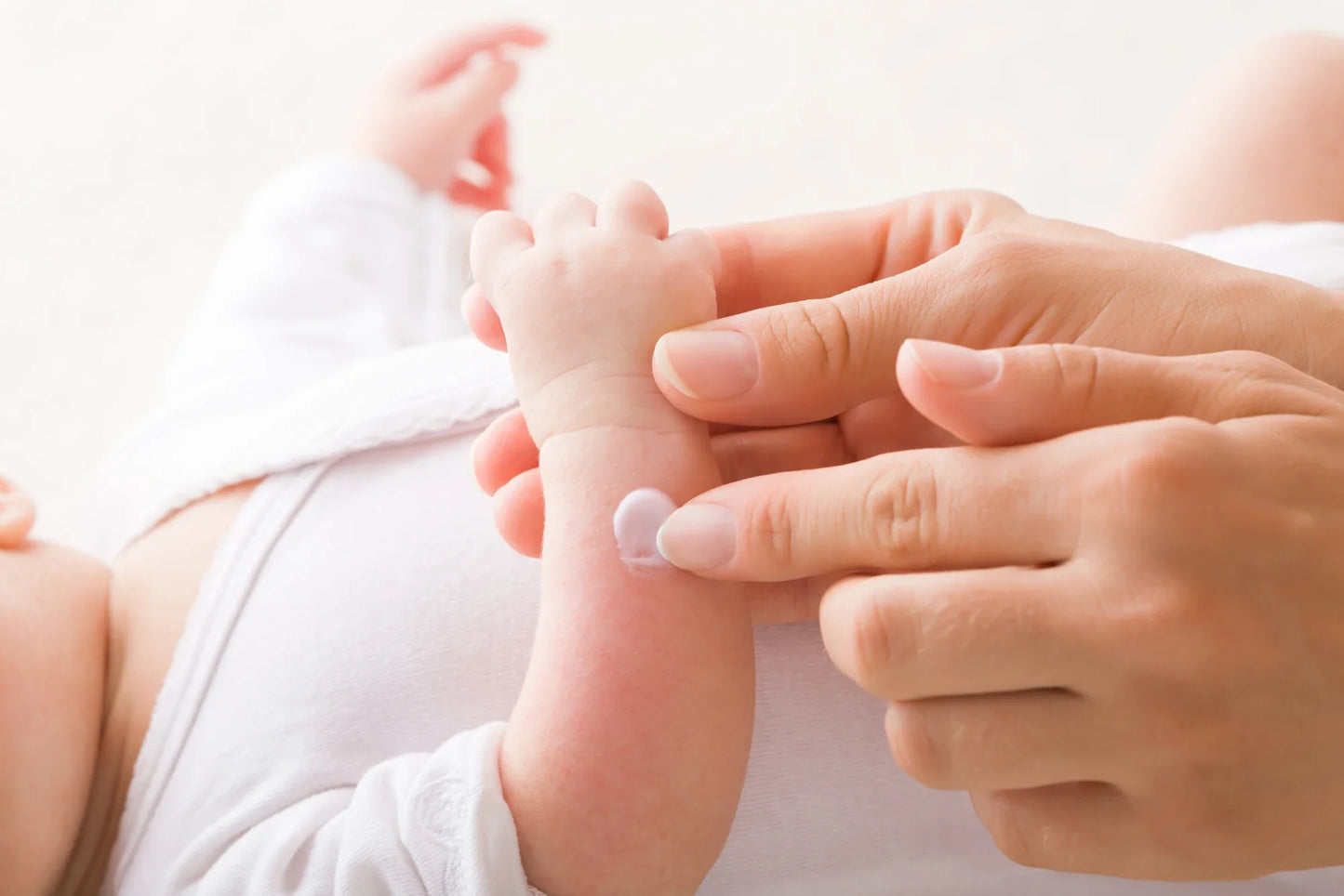 Atopische_Dermatitis_Kind