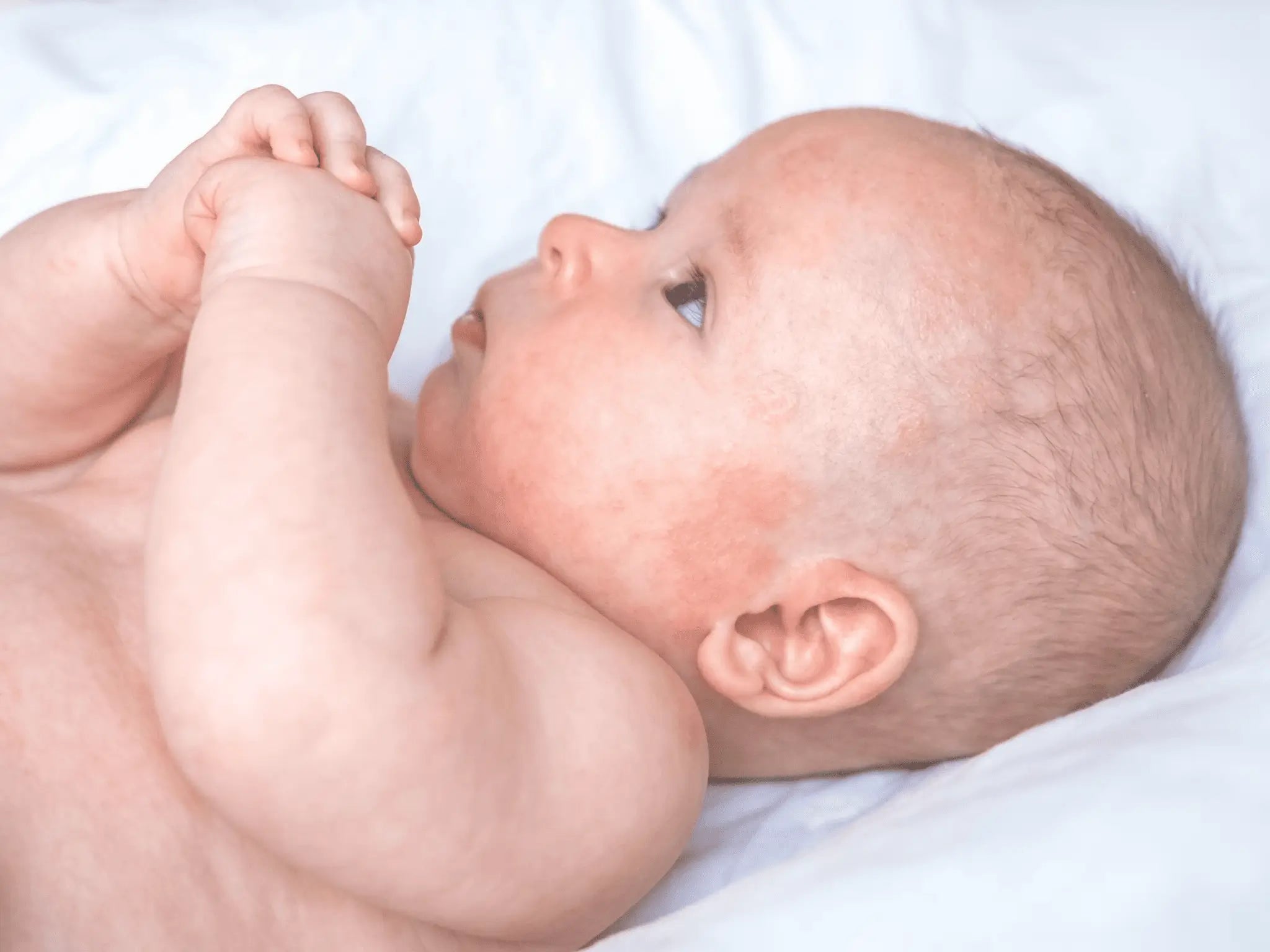 Leichte Neurodermitis bei Kindern: Früherkennung und sanfte Behandlung