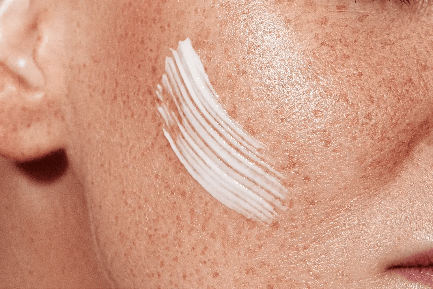 Gesicht mit trockener Haut und aufgetragener weißer Creme auf der Wange
