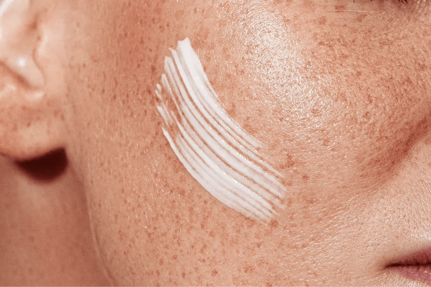 Gesicht mit trockener Haut und aufgetragener weißer Creme auf der Wange