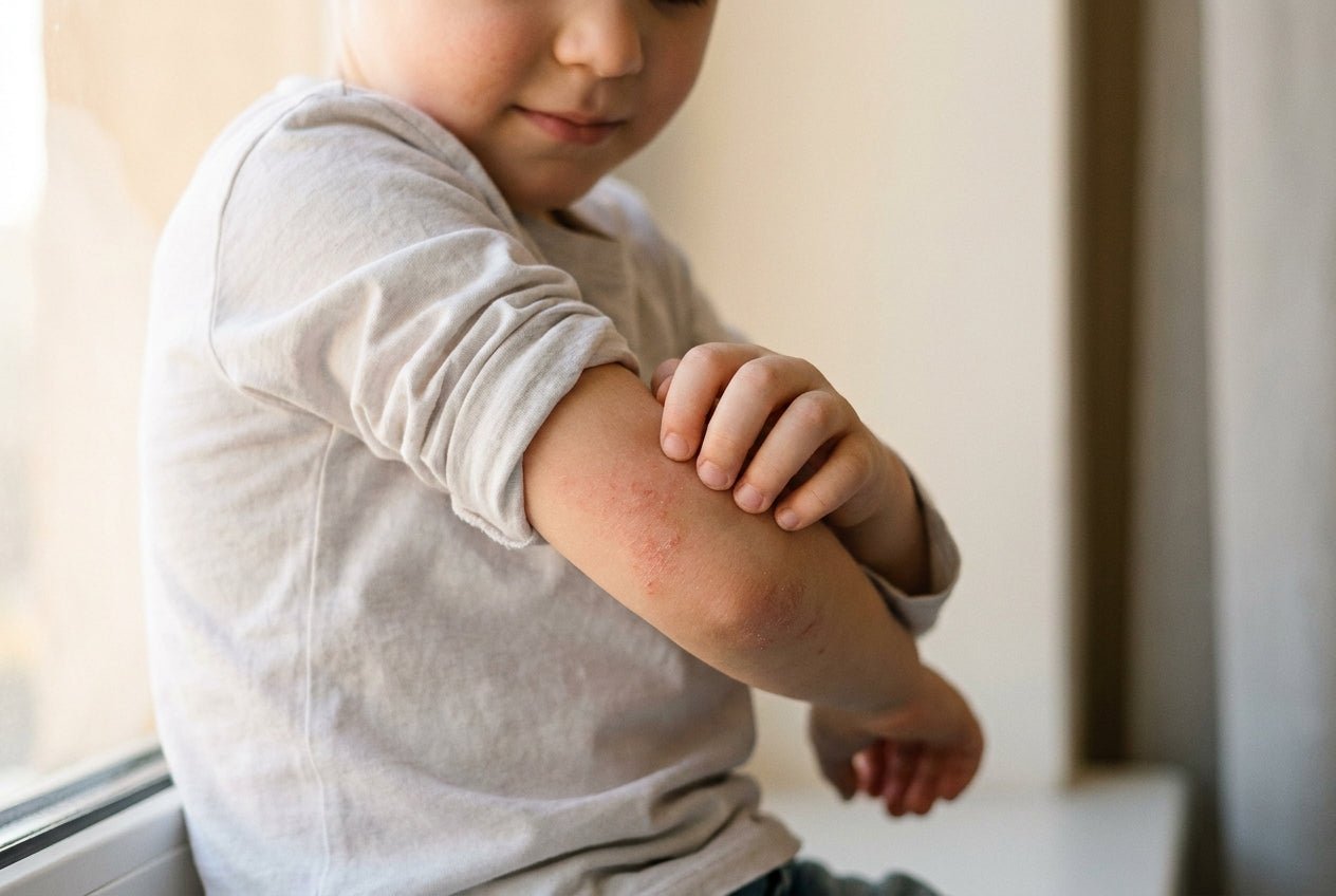Kind kratzt sich an der Armbeuge mit milder Rötung bei Neurodermitis