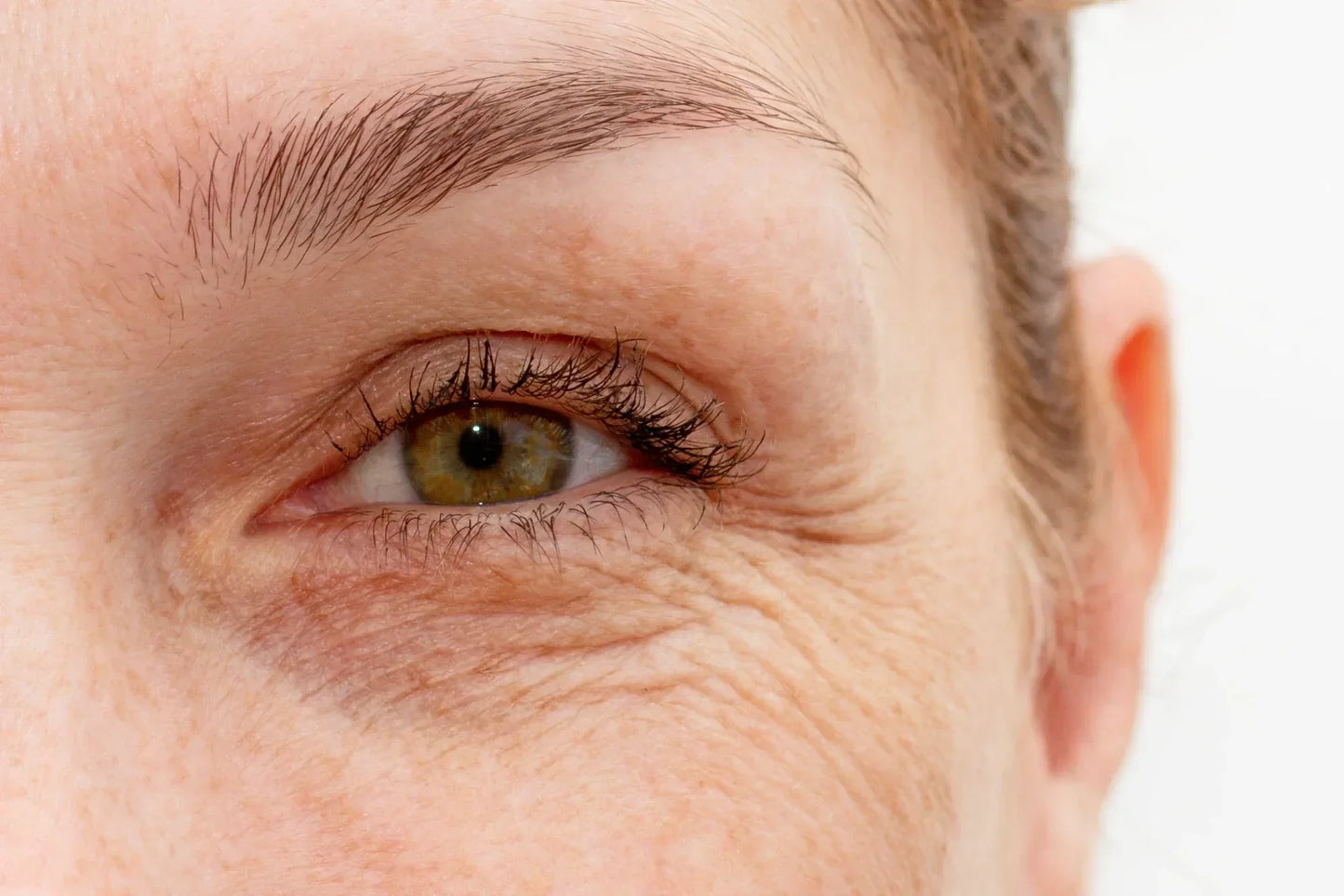 Falten im Gesicht: Ursachen & Top-Tipps gegen Falten!