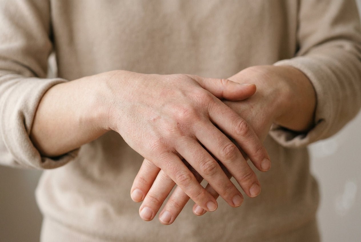 Milde Neurodermitis an den Händen mit trockener, leicht geröteter Haut am Handrücken