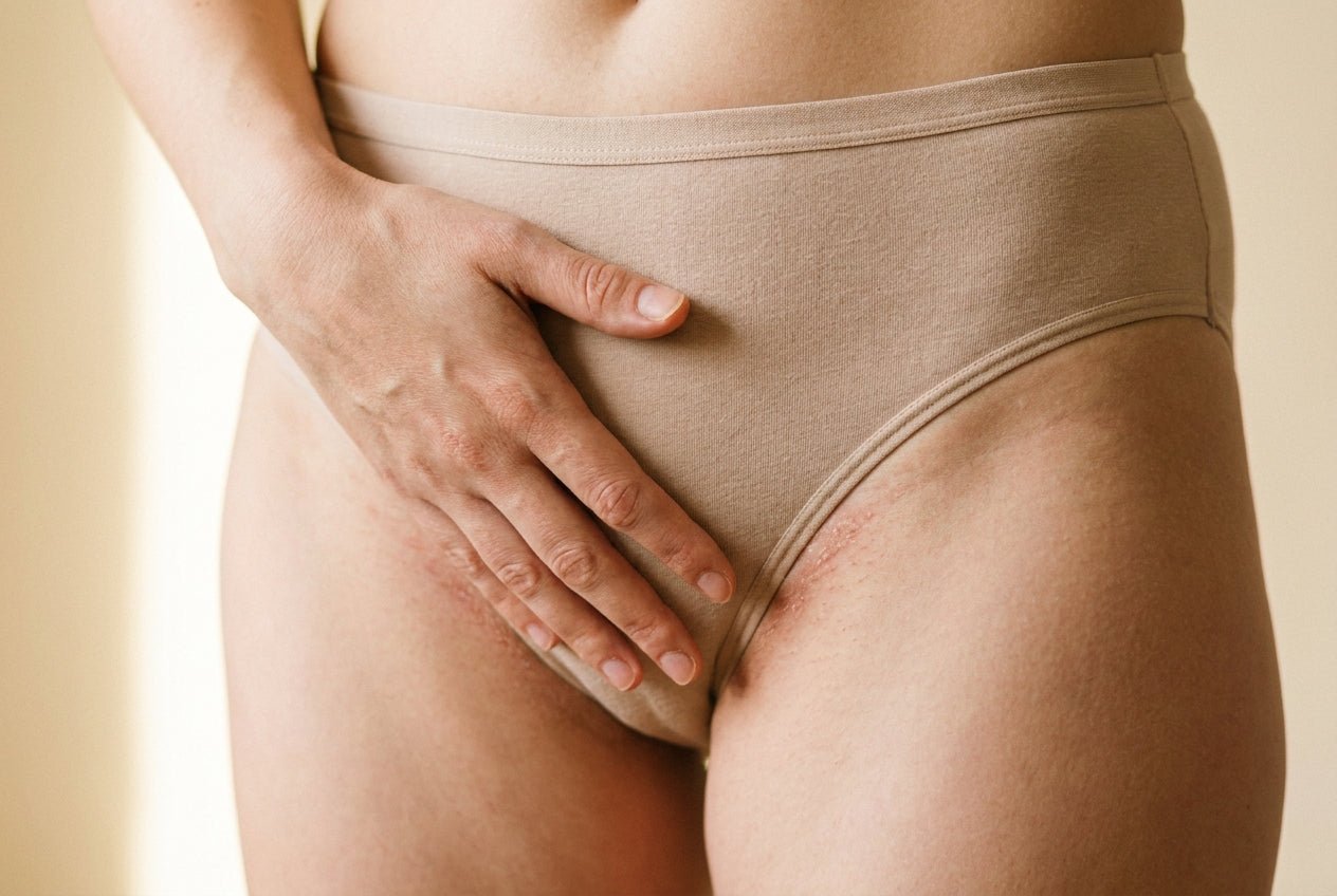 Hand auf Leistenbereich, milde Rötung und Trockenheit als trockene Intimhaut außen