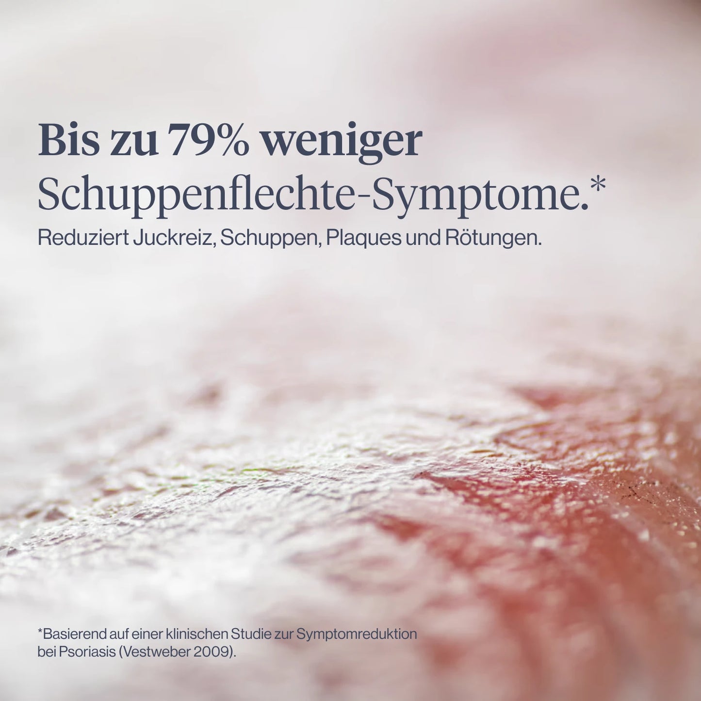 
                  
                    medEctoin® Psoriasis Akut Creme 5% 50ml
                  
                